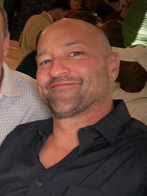 Scott, RLE Extend of depth IOL Scott, RLE Extend of depth IOL